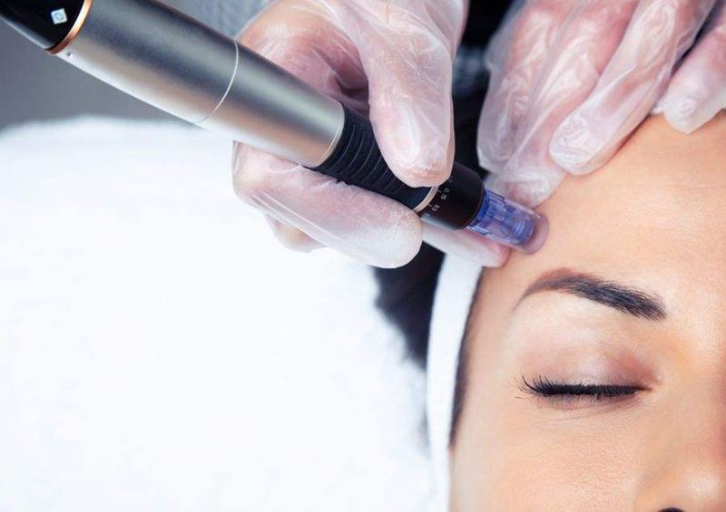 cosmetologist-making-microneedling-injection-scaled.jpg