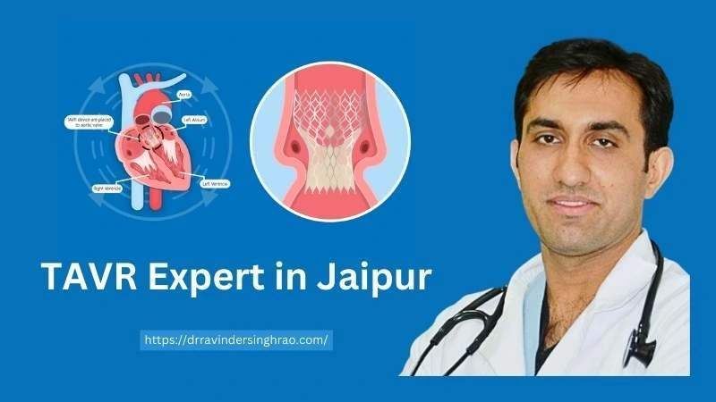 TAVR-Expert-in-Jaipur-.jpg