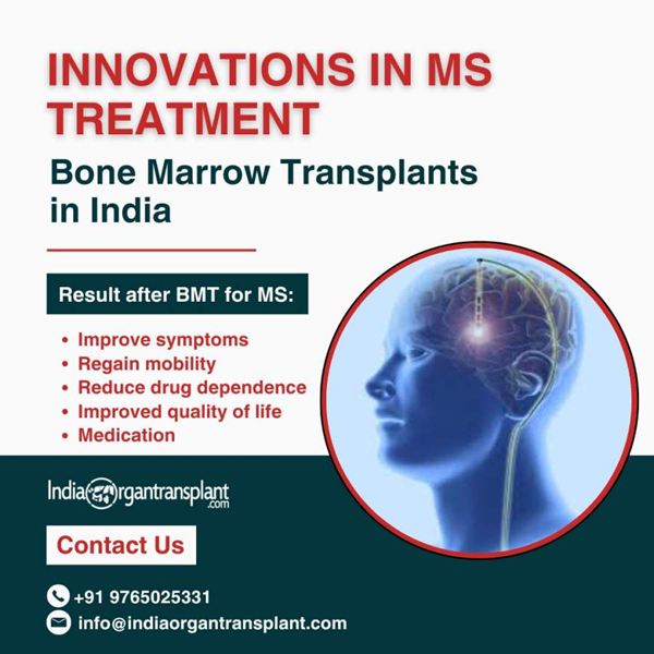 Innovations in MS Treatment Bone Marrow Transplants in India.jpg