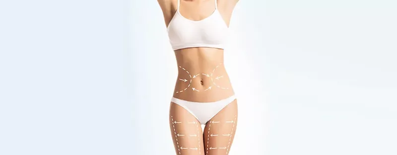 Procedure-of-Liposuction-Surgery-Dr-Rajat-Gupta.jpg