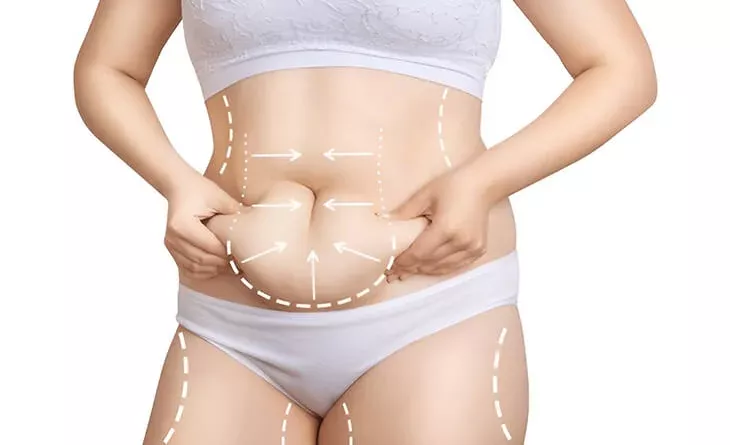 How-Liposuction-Can-Help-You-Achieve-Your-Ideal-Body-Shape-Dr-Rajat-Gupta-Plastic-Surgeon-in-Delhi-RG-Aesthetics-02.jpg