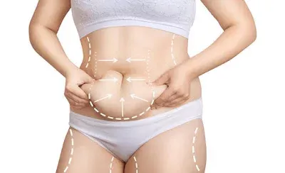 Liposuction.jpg