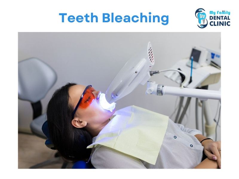 Teeth Bleaching -dental clinic in Kothrud- My Family Dental Clinic (1).jpg