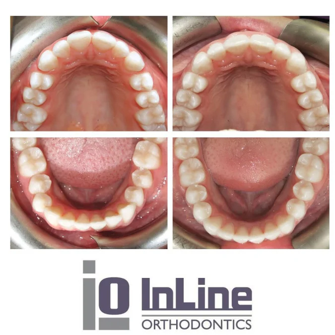 orthodontist calgary (10).jpg