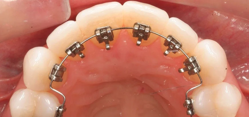 orthodontic2.jpg