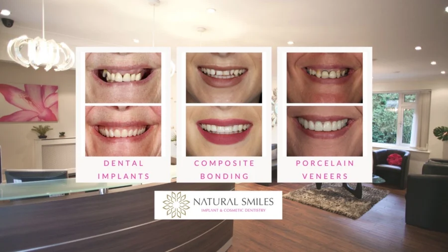 Natural Smiles Corby COVER PHOTO.jpg