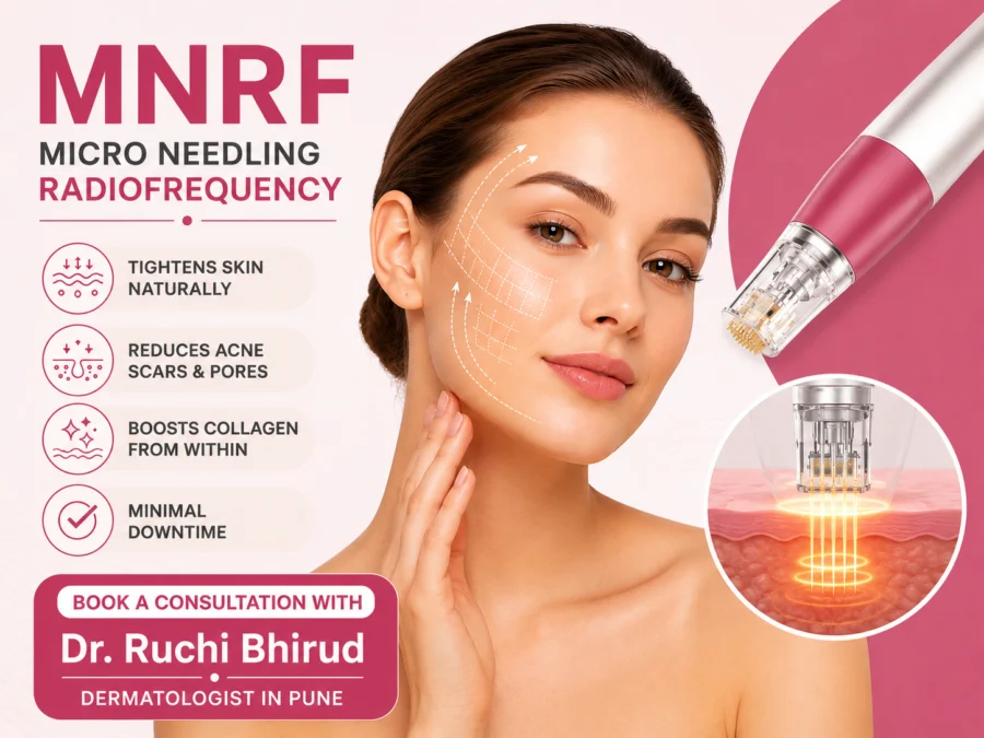 MNRF Treatment In Pune.png