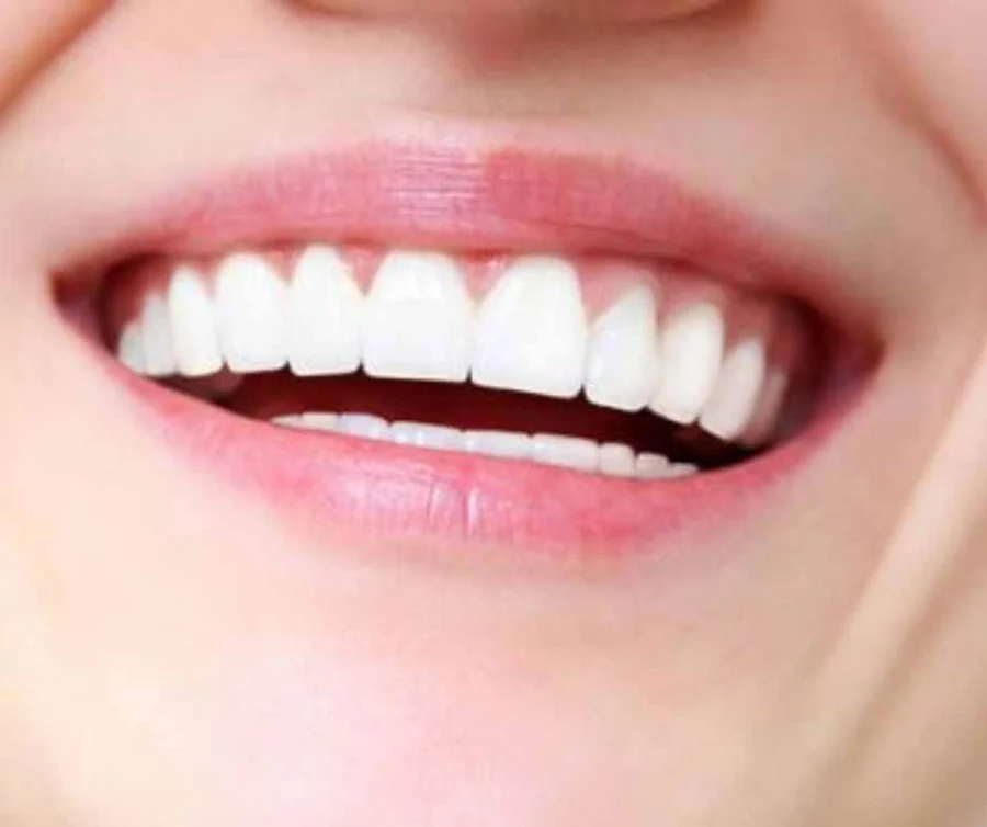 img-Gum-disease-treatment-Blackburn-Melbourne-at-Healthy-Smiles.jpg