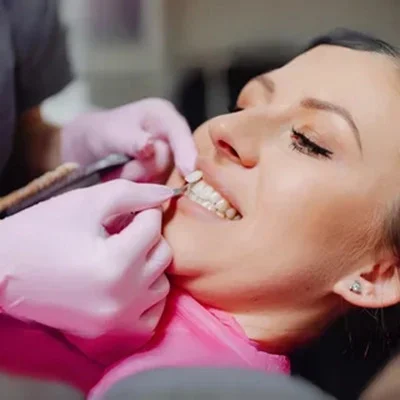 dental-veneers-treatment.jpg